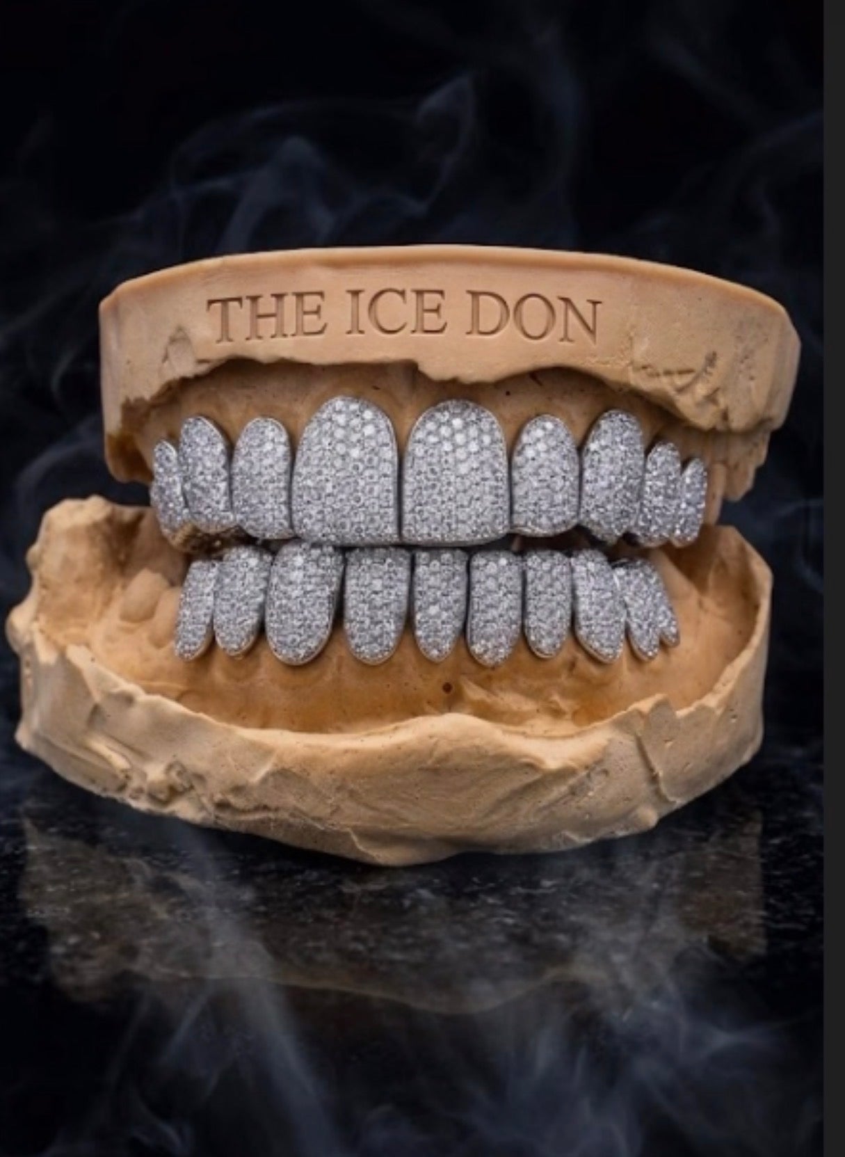 Custom Vs Natural Diamond Grillz
