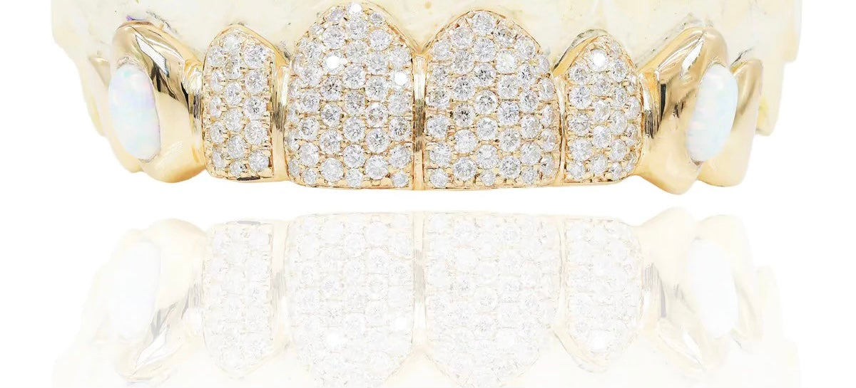 8 TOP 10K YELLOW GOLD VS DIA 2X OPAL CANINES