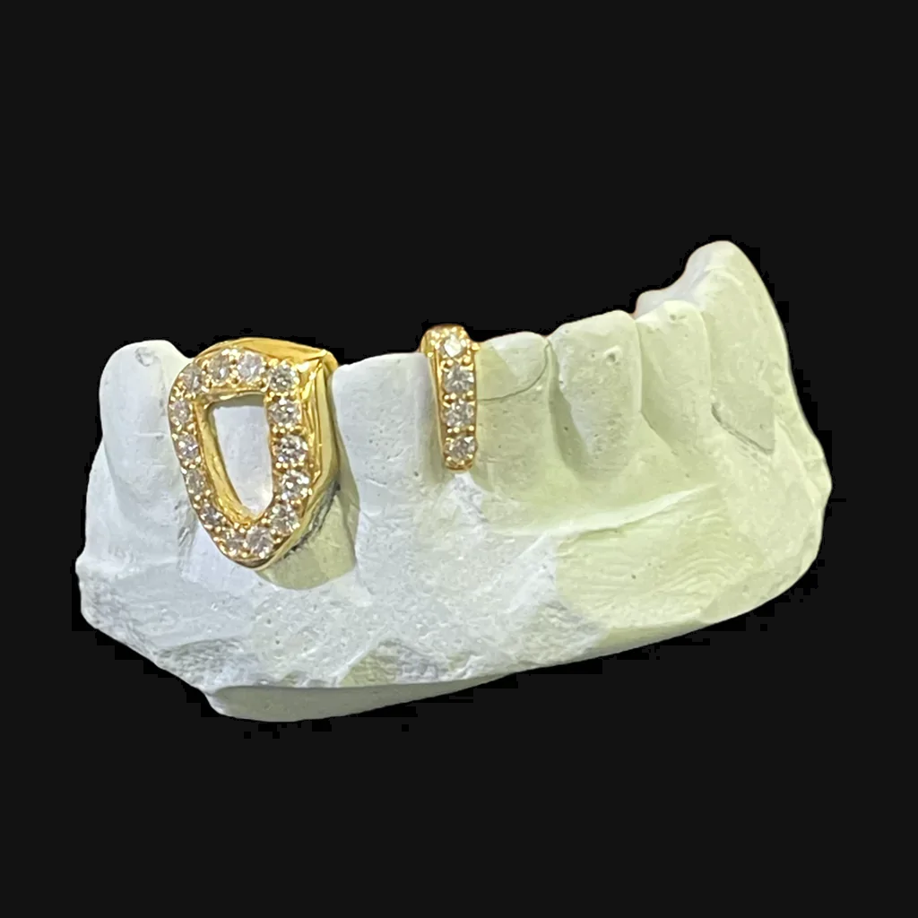 DIAMOND SPACER GRILL
